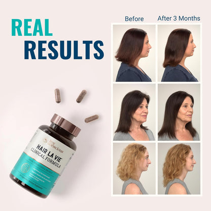 Hair La Vie Live Conscious Clinical Formula Hair Growth Vitamins for Women and Men w/Biotin 5000mcg, Collagen & Saw Palmetto (Pack of 1)