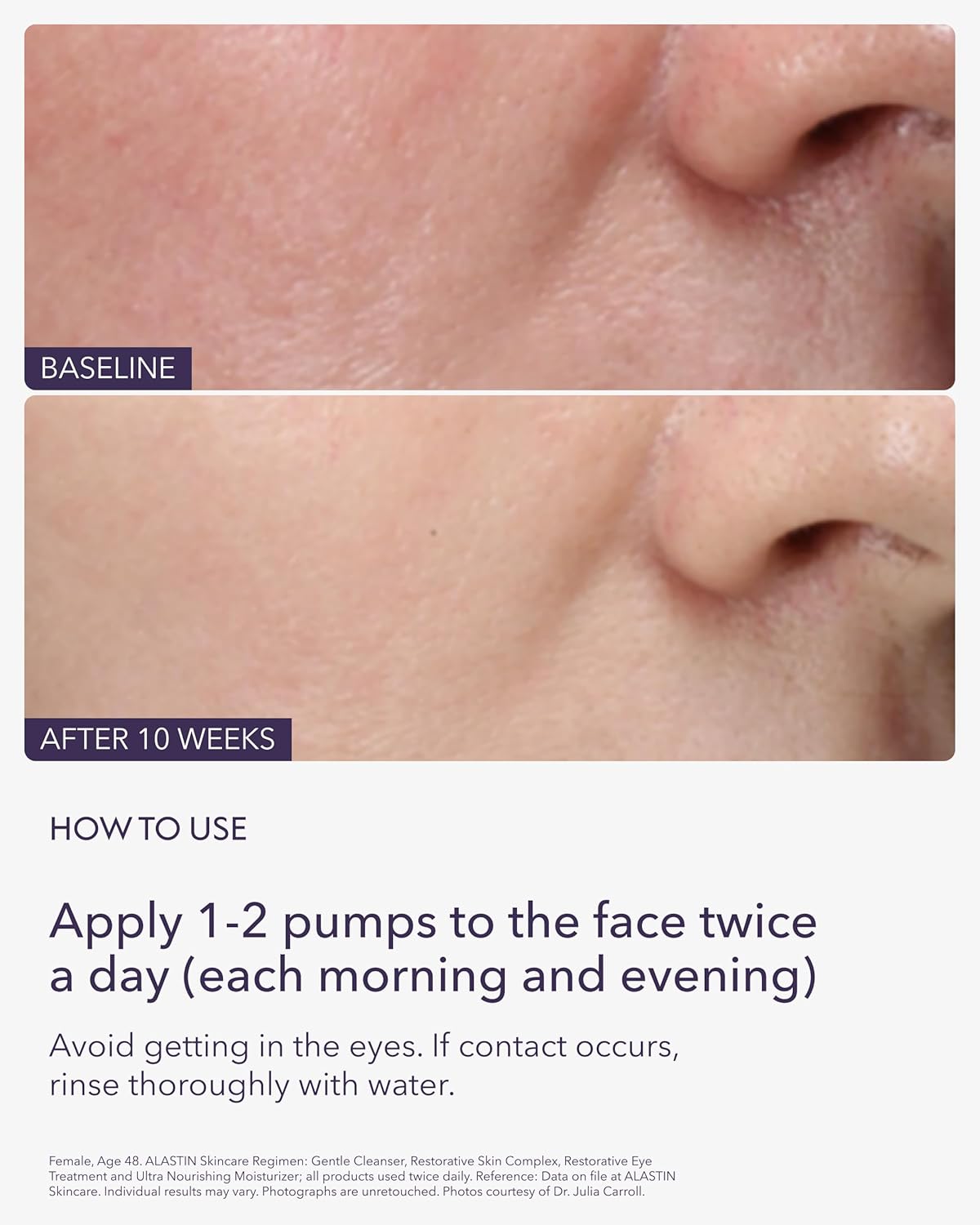 ALASTIN Skincare Restorative Skin Complex Anti - Aging Face Serum (1 oz) | Reduce Fine Lines & Wrinkles | With Niacinamide to Improve Texture - Wholesale Rabbits