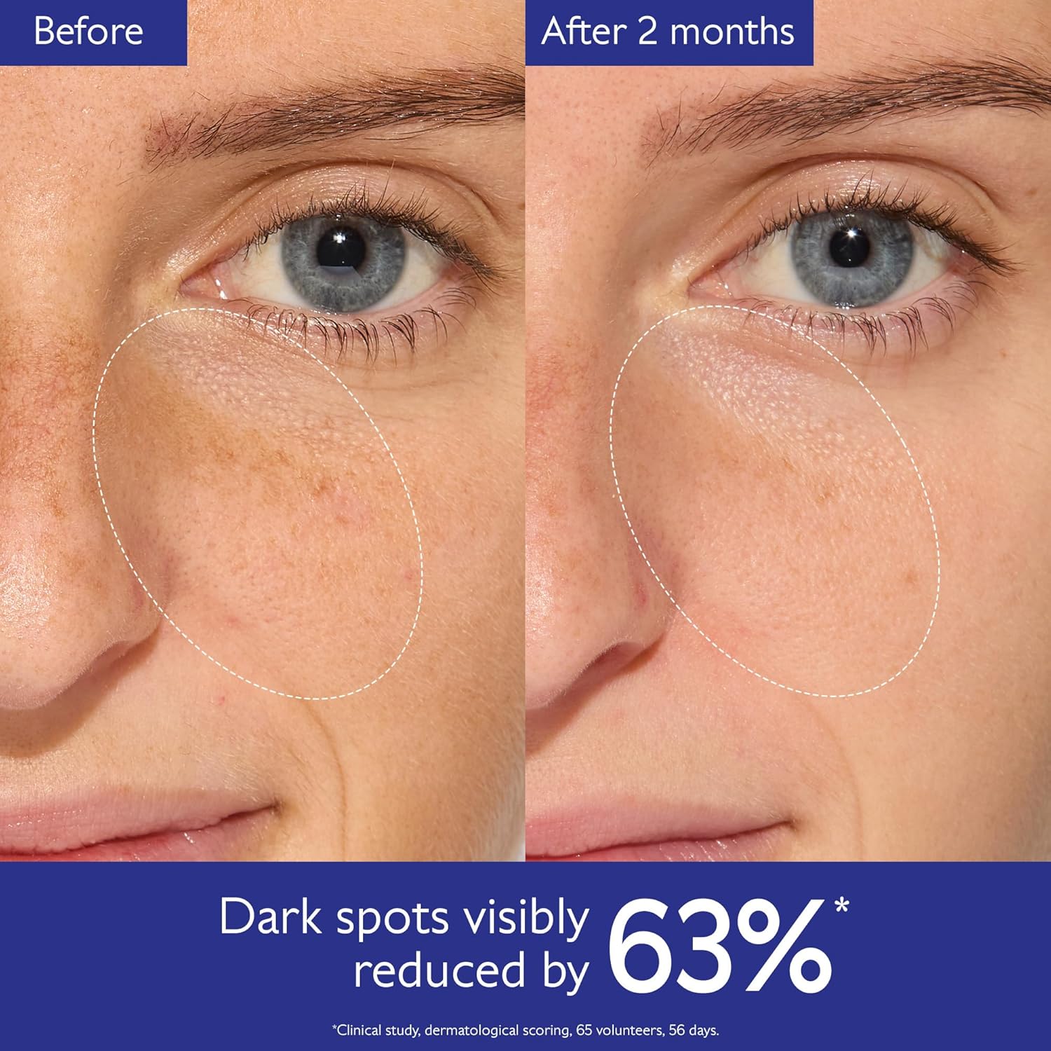 Caudalie Vinoperfect Brightening Dark Spot Serum Vitamin C Alternative - 62x More Effective than Vitamin C with Viniferine for a Visibly Brighter Even Complexion - Wholesale Rabbits