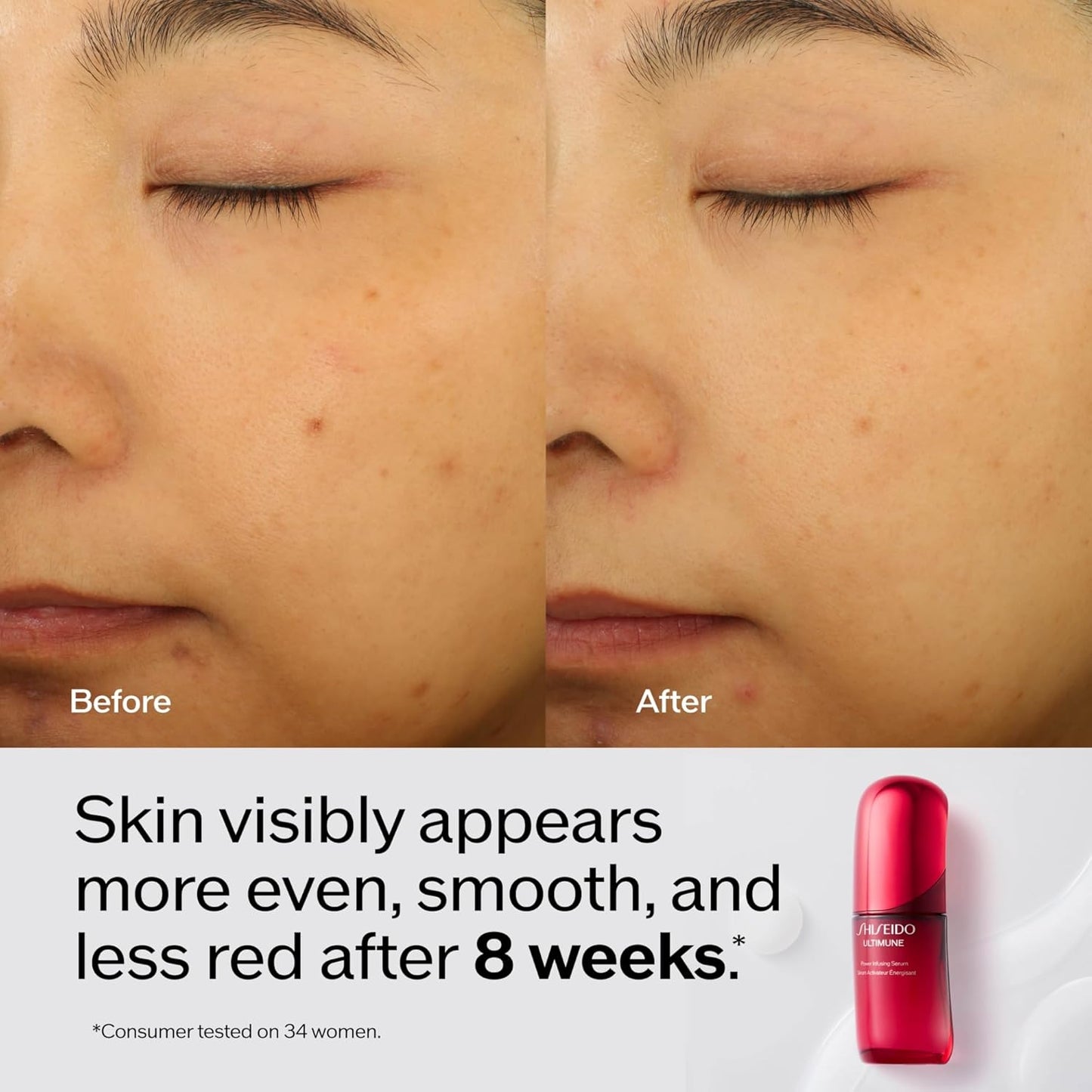 Shiseido Ultimune Power Infusing Serum - Breakthrough Lightweight Face Serum - Boosts Radiance & Improves Visible Signs of Aging - All Skin Types - Non - Comedogenic - Wholesale Rabbits