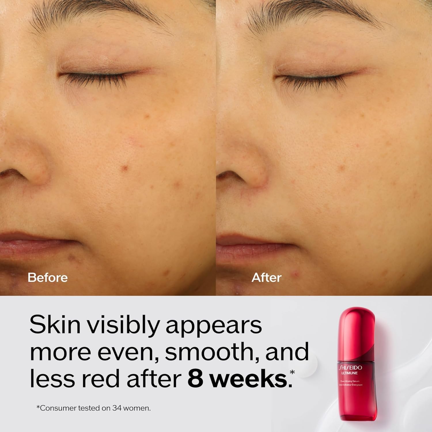 Shiseido Ultimune Power Infusing Serum - Breakthrough Lightweight Face Serum - Boosts Radiance & Improves Visible Signs of Aging - All Skin Types - Non - Comedogenic - Wholesale Rabbits